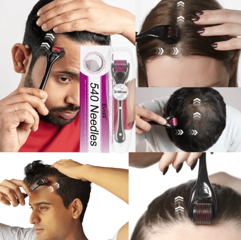 7 Days Hair Growth Serum with 540 Micro - Needle Derma RollerFlexora Gadgets