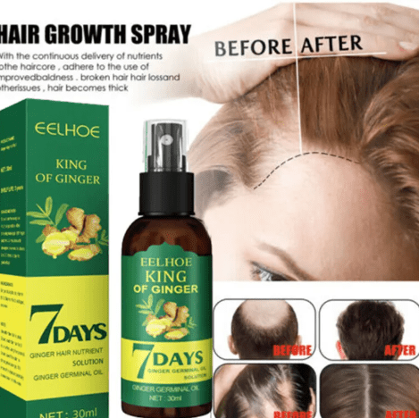 7 Days Hair Growth Serum with 540 Micro - Needle Derma RollerFlexora Gadgets