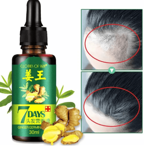 7 Days Hair Growth Serum with 540 Micro - Needle Derma RollerFlexora Gadgets