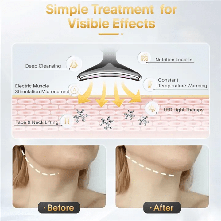 Anti Wrinkles Face Massager - Free ShippingFlexora Gadgets