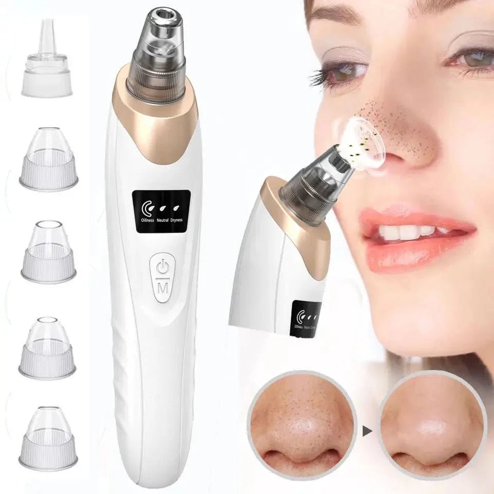 Electric Blackhead Remover, Vacuum Acne Cleaner Removal DeviceFlexora Gadgets